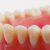 دندان مصنوعي با بيمه - تصویر1