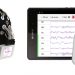 الکتروانسفالوگرافی اسمارتینگ (smarting EEG)