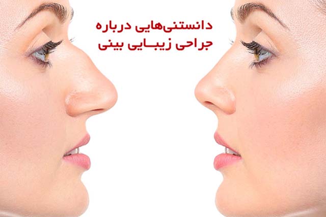 جراحی زیبایی بینی