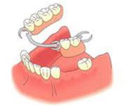 پایه پلاک دندان متحرک
