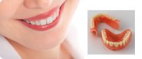 complete-dentures1