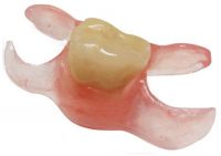 one-tooth-valplast