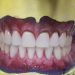 دندانسازی ارزان در تهرانسر