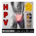 اسپری کرایوتراپی(درمان HPV و زگیل تناسلی)