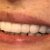 دندانپزشكي با تخفيفات ويژه در تبريز - تصویر1