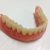 دندان سازی ارزان قیمت - تصویر2