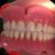 دندان رایگان دندانسازی - تصویر2