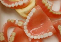 دندان سازی دندان رایگان