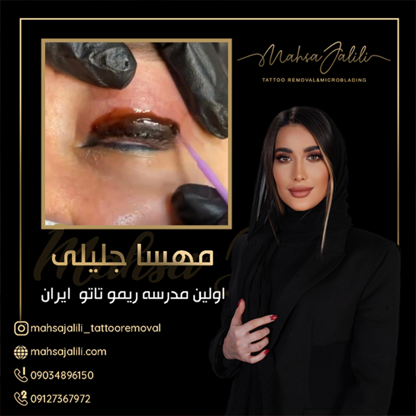 ریموو تاتو خط چشم بابروزترین متدهای مهسا جلیلی به صورت تضمینی