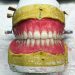 ساخت انواع دندان مصنوعی،ساخت پلاک کروم کبالت براساس فک،ساخت پروتز