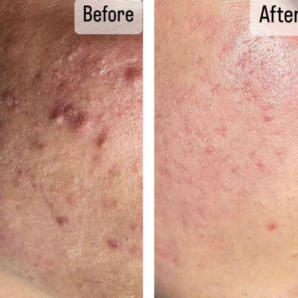 beautyskincarebyfifi_14010709_024147370