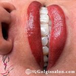 شیدینگ لب در تهران باتخصصی ترین روشهای گل گیس به صورت تضمینی