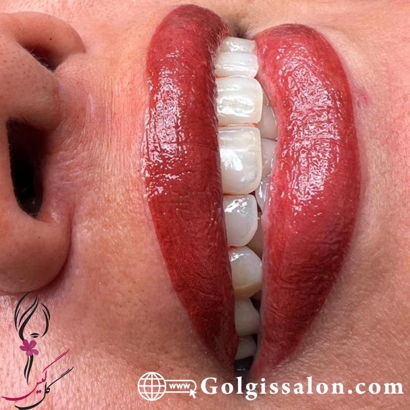 شیدینگ لب در تهران باتخصصی ترین روشهای گل گیس به صورت تضمینی