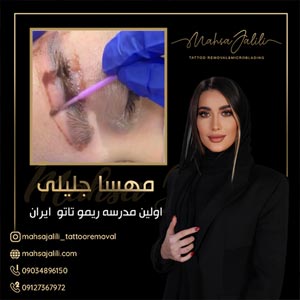 تاتو ابرو تخصصی باجدیدترین روشهای پاک کردن تاتو در مدرسه تخصصی ریموو تاتو مهسا جلیلی