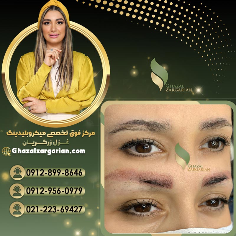 کردن میکروبلیدینگ ابرو با غزل زرگریان با بهترین روشها