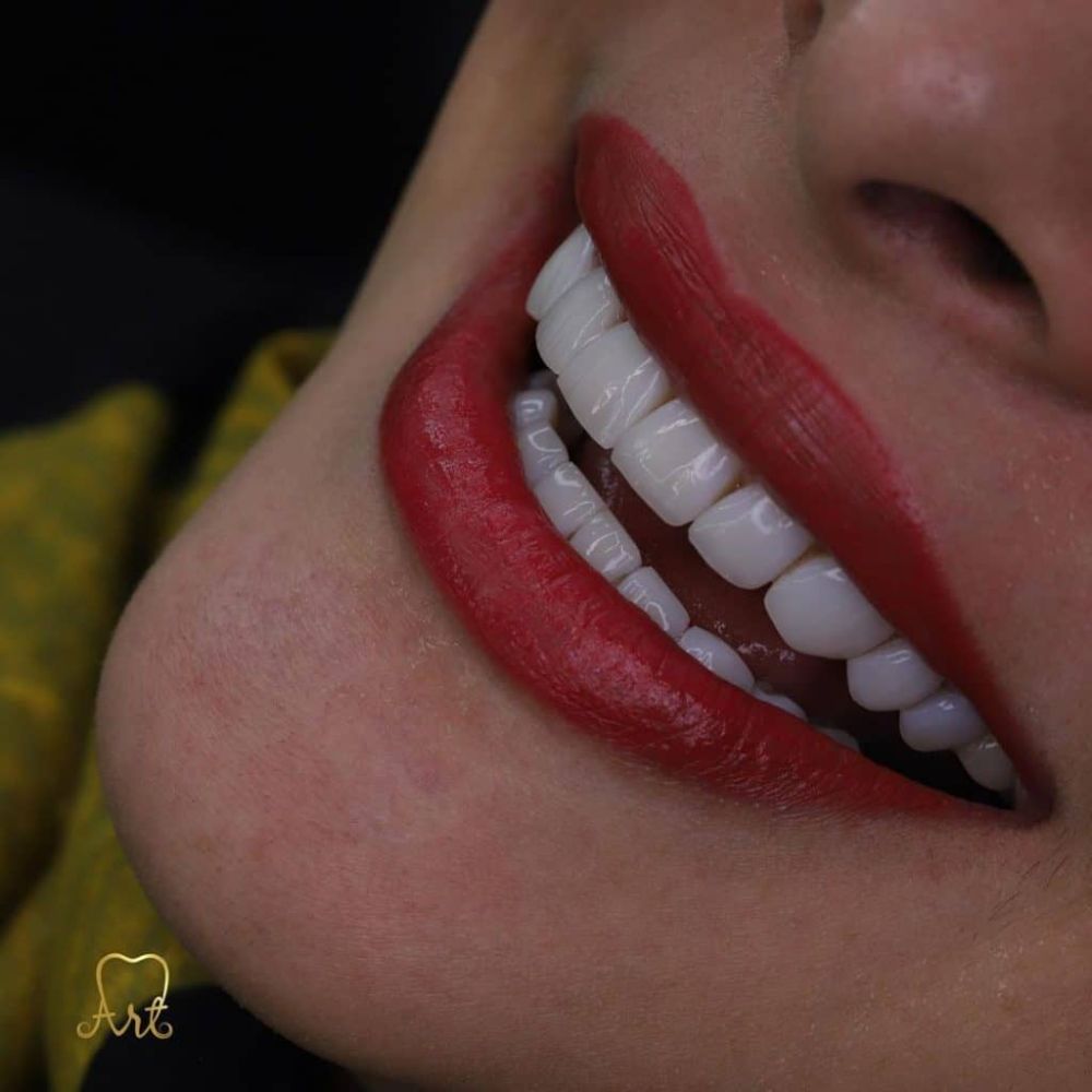 composite1