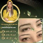 مرکز ریموو ابرو در تهران با غزل زرگریان با کیفیت عالی