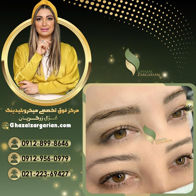 مرکز ریموو ابرو در تهران با غزل زرگریان با کیفیت عالی
