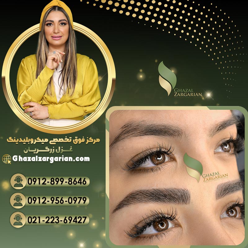 کرکی مویی در مرکز تخصصی غزل زرگریان به بهترین شکل