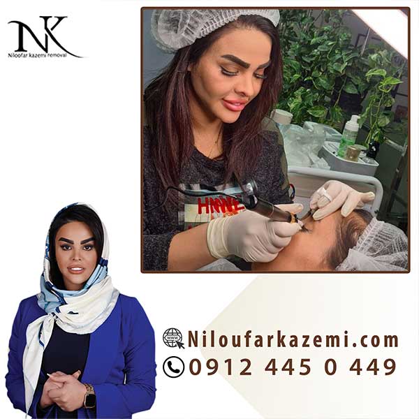 ریموو تاتو خط چشم به صورت پیشرفته با استاد نیلوفر کاظمی