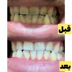 photo-output