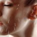 دوره آموزش طب سوزنی زیبایی