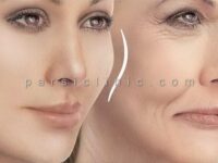 تزریق-چربی-صورت-جای-فیلر-و-بوتاکس