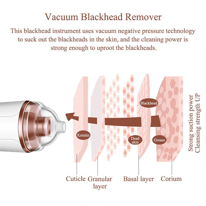 Carina X1003 Vacuum Blackhead Remover (3)