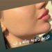 اموزش ژل وبوتاکس