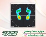 کفش طبی خار پاشنه در تهران | کفی طبی خارپاشنه در تهران