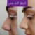 مرکز پوست ، مو ، زیبایی و لیزر شارلوت - تصویر2