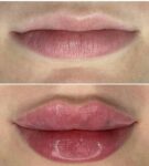 مرکز پوست ، مو ، زیبایی و لیزر شارلوت