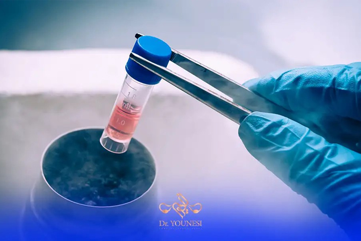 فرآیند فریز تخمک